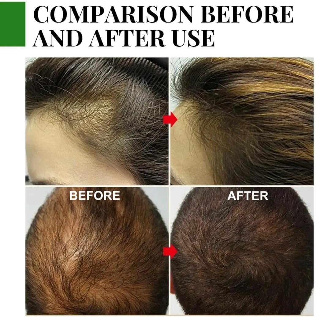 ORANGLES Rosemary Oil for Hair – Strengthen & Revitalize Treatment - detailed closeup view - illustrating benefits - Image 3 of 6 | created for all | Shop Rosemary Oil for Hair – Strengthen & Revitalize Treatment North Carolina | Free Shipping ORANGLES