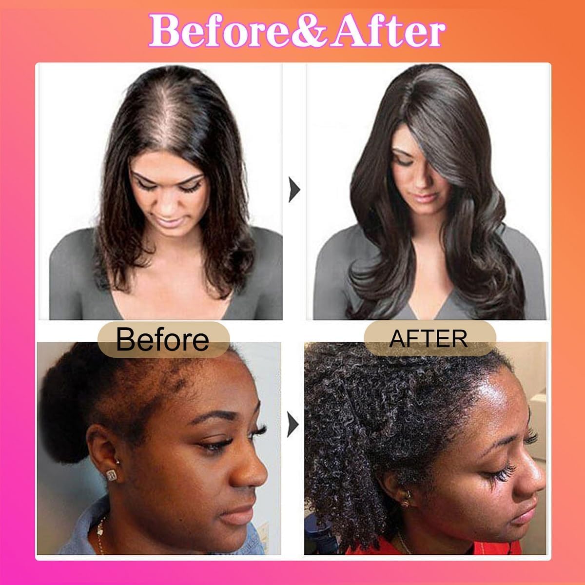 ORANGLES Boost Hair Growth Instantly with Batana Oil – Longer, Stronger Hair! - angled perspective - presenting advantages - Image 4 of 6 | fits any environment | Purchase Boost Hair Growth Instantly with Batana Oil – Longer, Stronger Hair! Michigan | Free Shipping ORANGLES