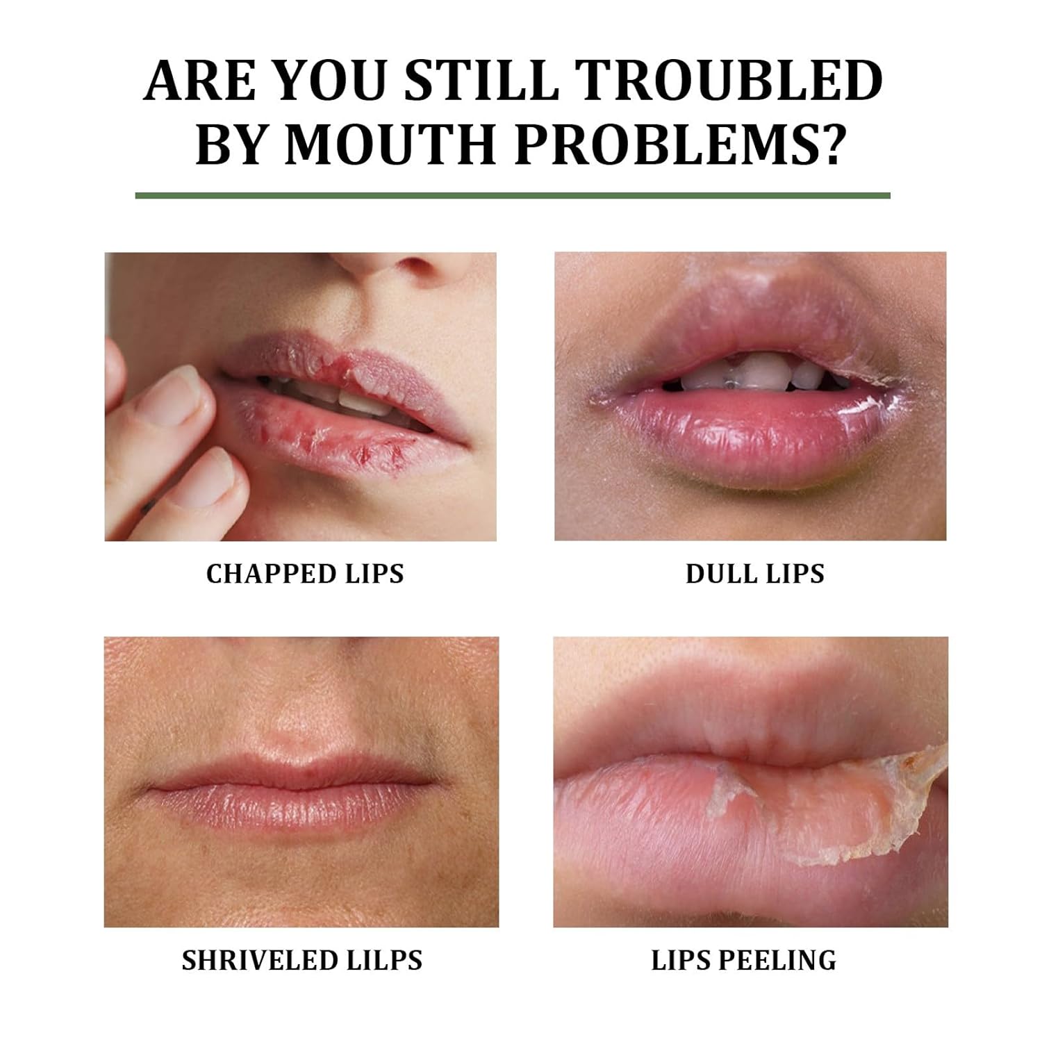 ORANGLES Eelhoe Moisturizing Lip Balm – Hydrate & Soften Dry Lips - detailed closeup view - illustrating benefits - Image 3 of 7 | created for all | Shop Eelhoe Moisturizing Lip Balm – Hydrate & Soften Dry Lips North Carolina | Free Shipping ORANGLES