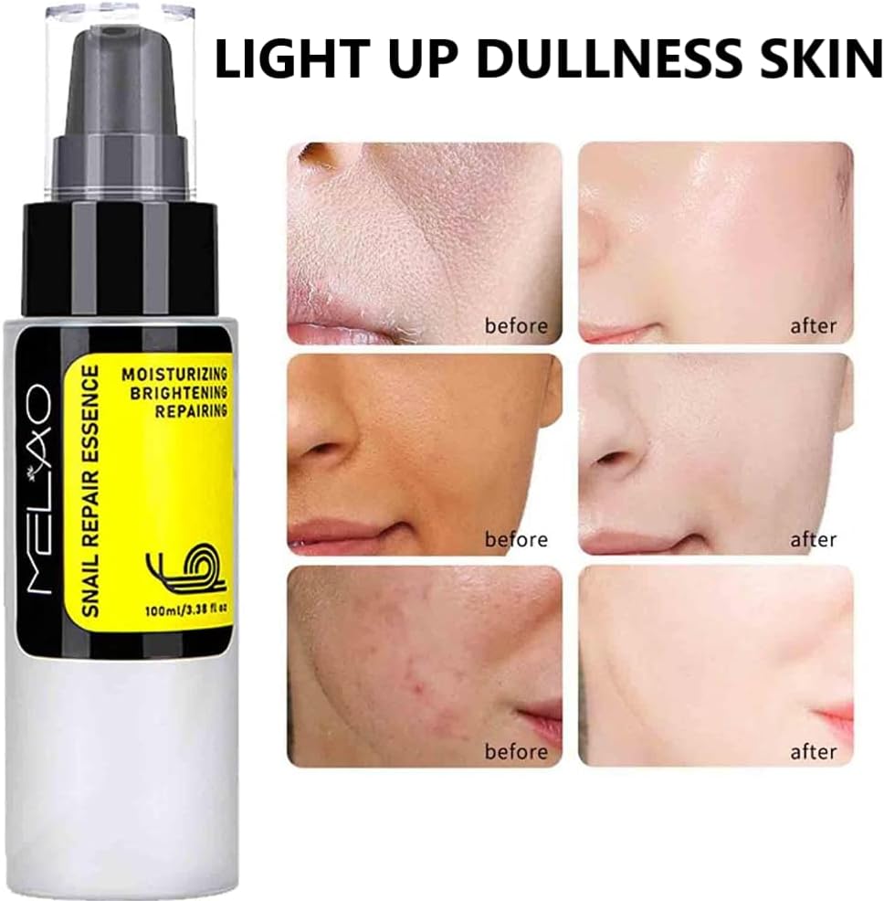 ORANGLES Snail Facial Solution – Hydrating, Anti‑Aging & Repair - elegant presentation - exhibiting components - Image 6 of 6 | ideal for home | Discount on Snail Facial Solution – Hydrating, Anti‑Aging & Repair Virginia | Free Shipping ORANGLES