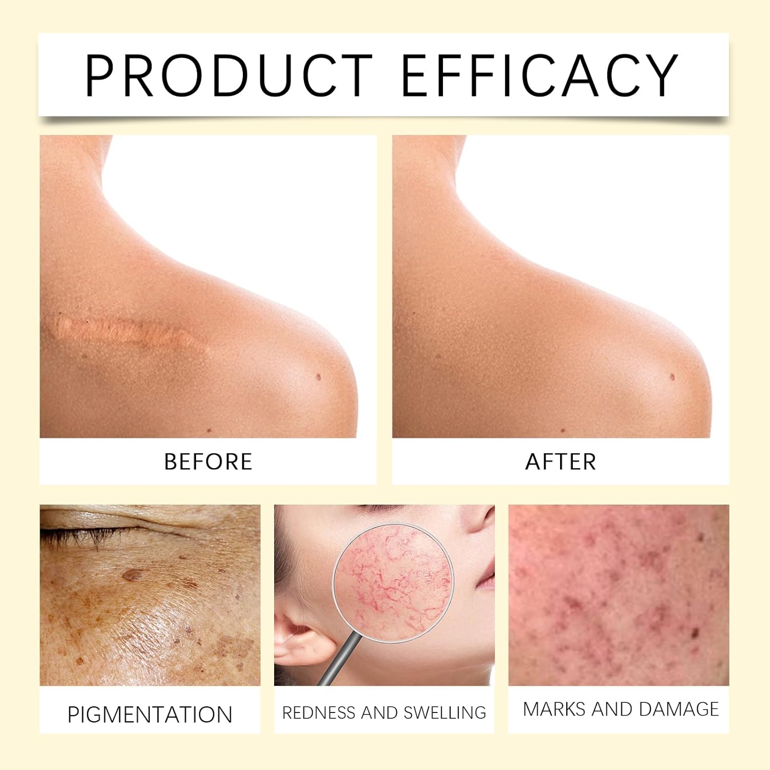 ORANGLES HOUKEA Bee Venom Skin Care Cream – Anti‑Aging, Hydrating & Skin Repair Treatment - full product showcase - displaying specifications - Image 5 of 5 | adapts to any space | HOUKEA Bee Venom Skin Care Cream – Anti‑Aging, Hydrating & Skin Repair Treatment deal New Jersey | Free Shipping ORANGLES